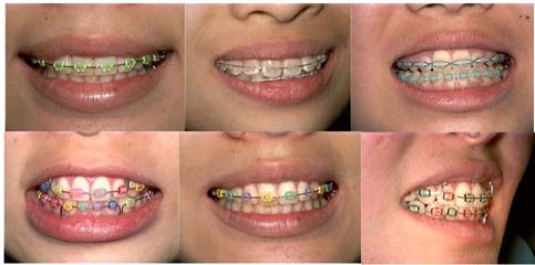 ortho
